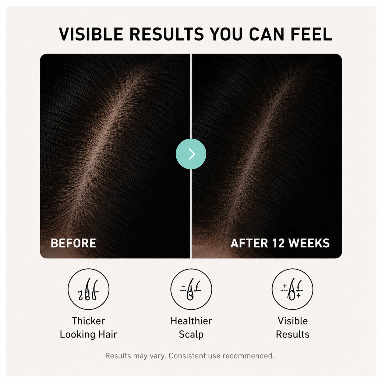 Velora HairAmpoule — PDRN Microneedling Hair Serum